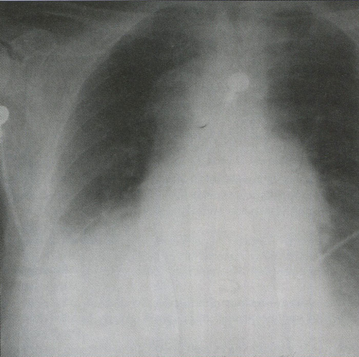 Рентгенограмма