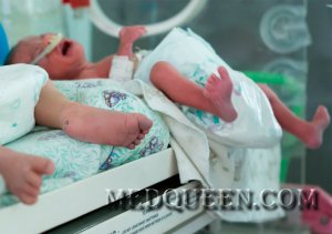 Асфиксия у новорожденных