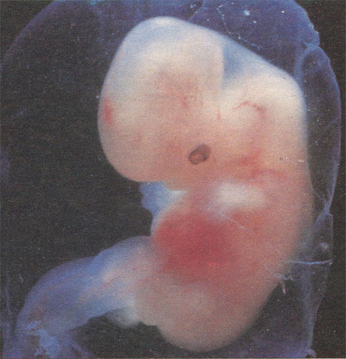Человеческий зародыш 5—6 недель