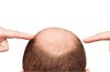 Восстановление волос: что нужно знать?
