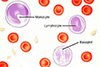 Анализ крови: Лейкоциты